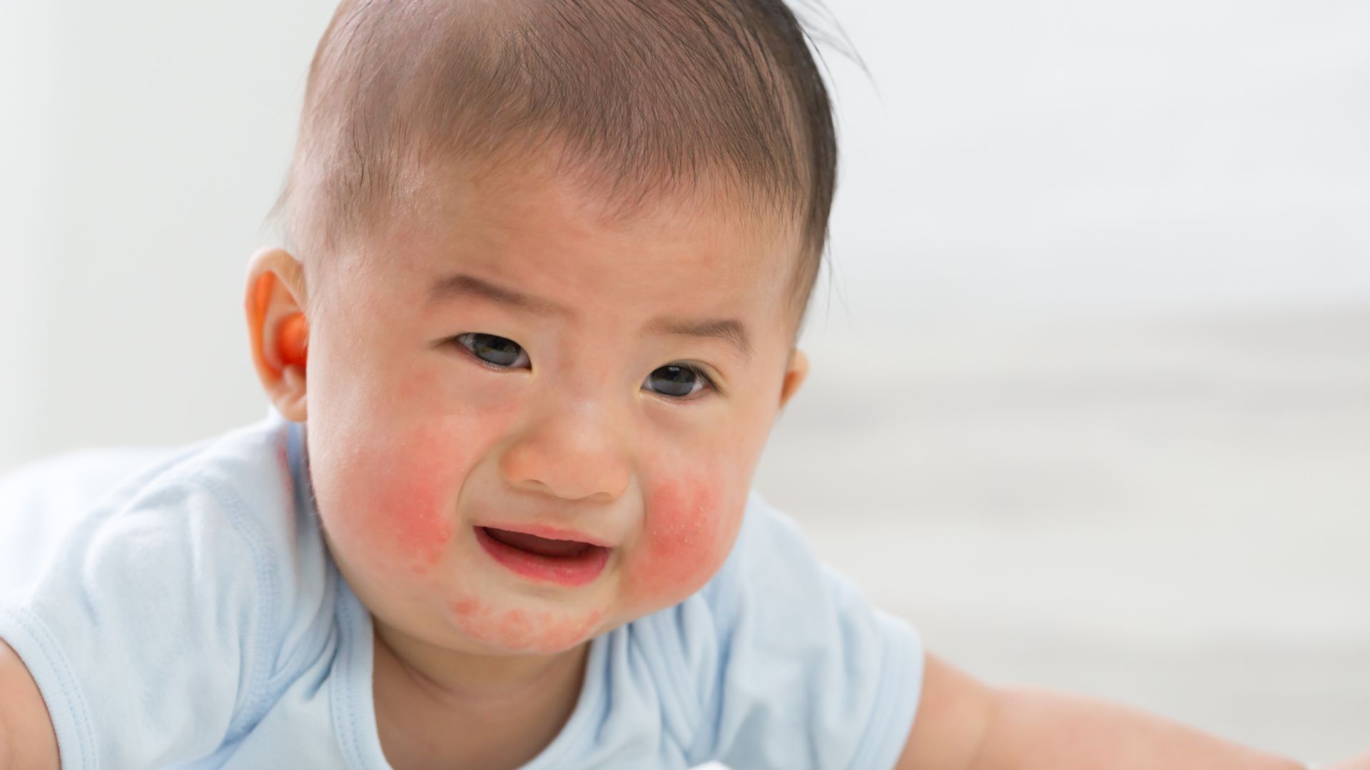 Bé dị ứng dầu mè