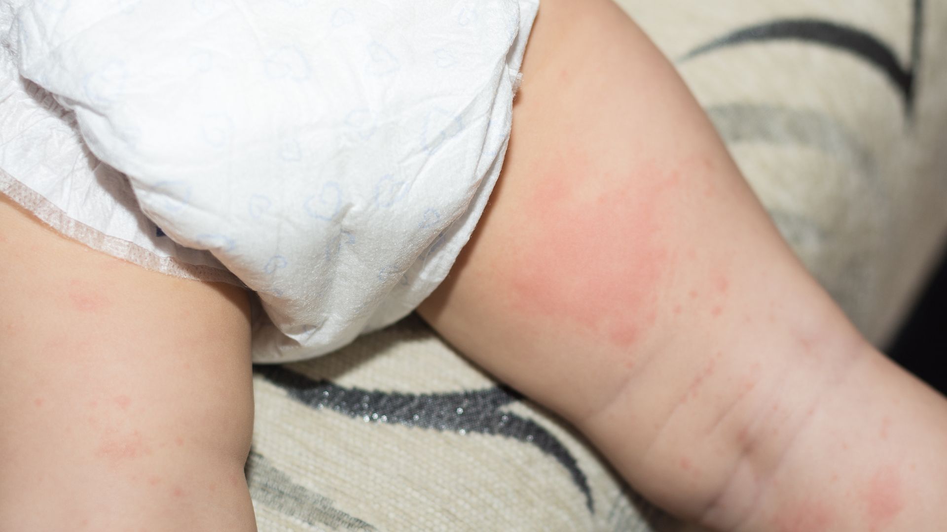 Thanh long cho bé ăn dặm giúp hạn chế bị hăm tã